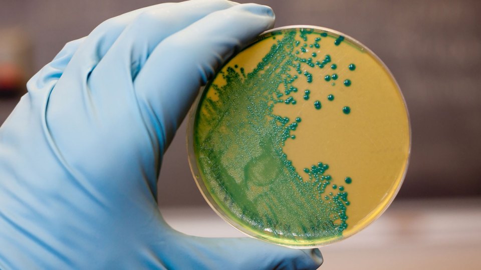 listeria riski yayılıyor - Listeria riski yayılıyor, peynirde küresel alarm endişesi