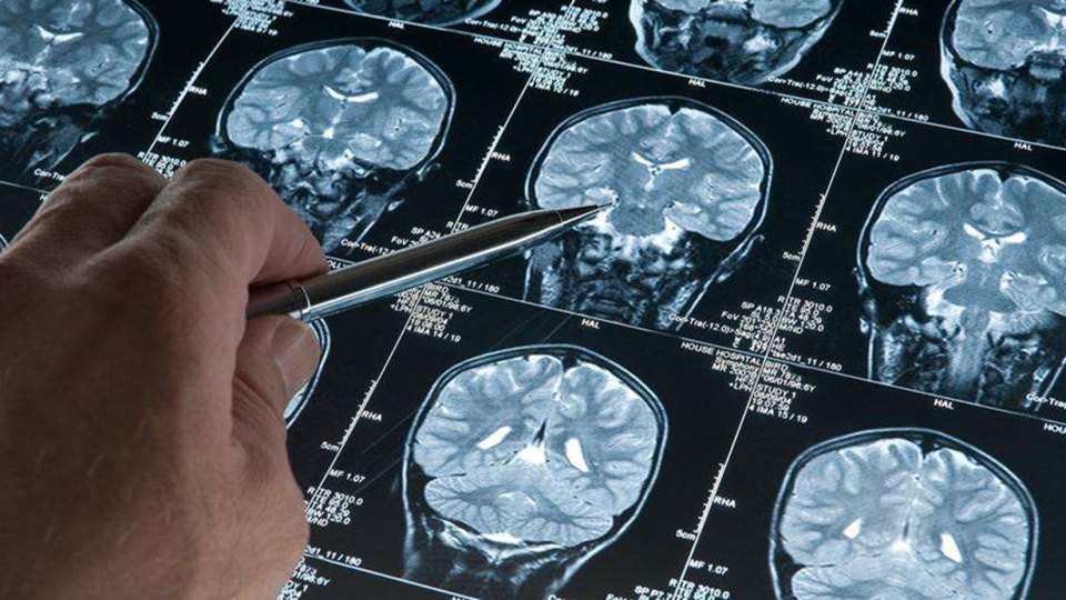 derin uyku alzheimer - Derin uyku Alzheimer hastalığının ilerlemesini durduruyor