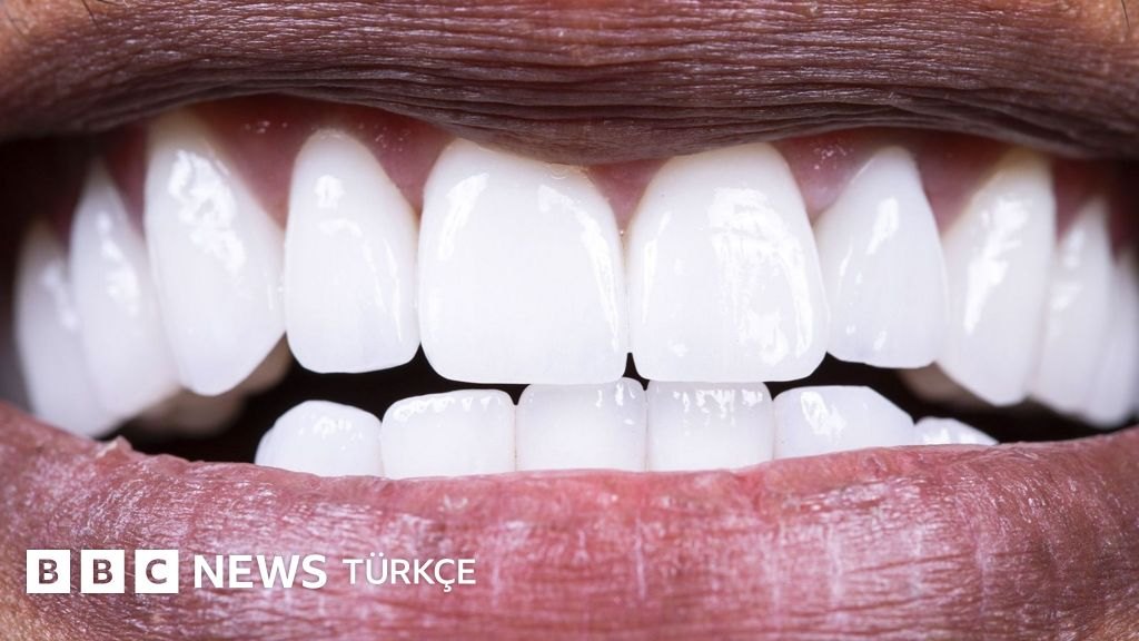 Ağzınızdaki iyi bakterileri korumak için beslenme ipuçları